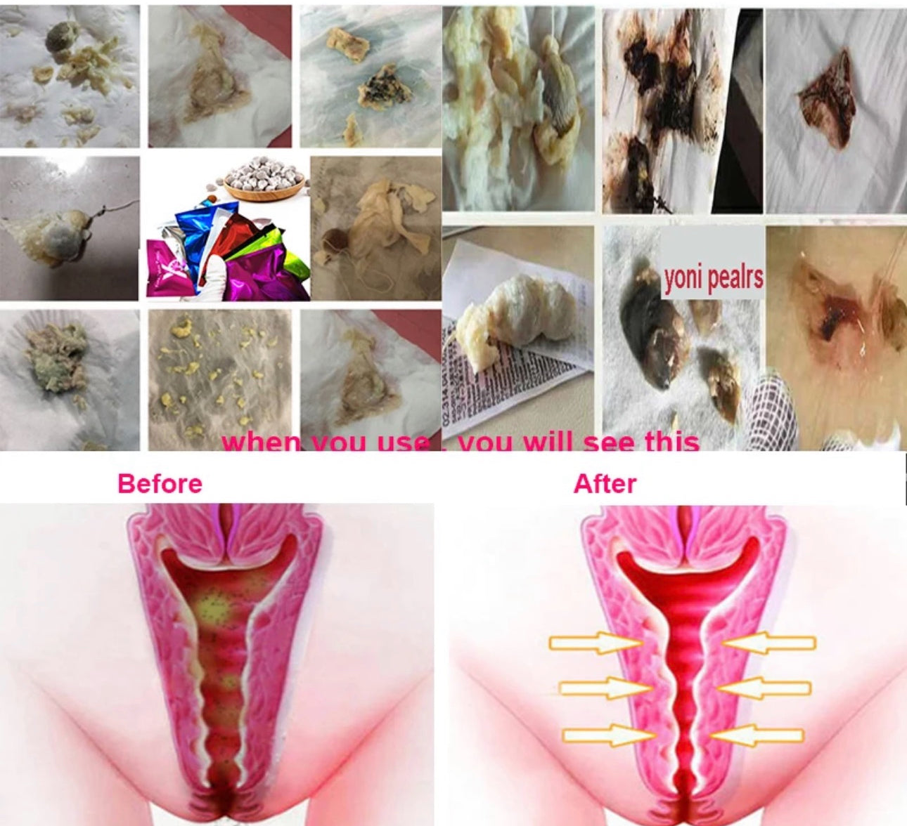 Detox tampons vaginal